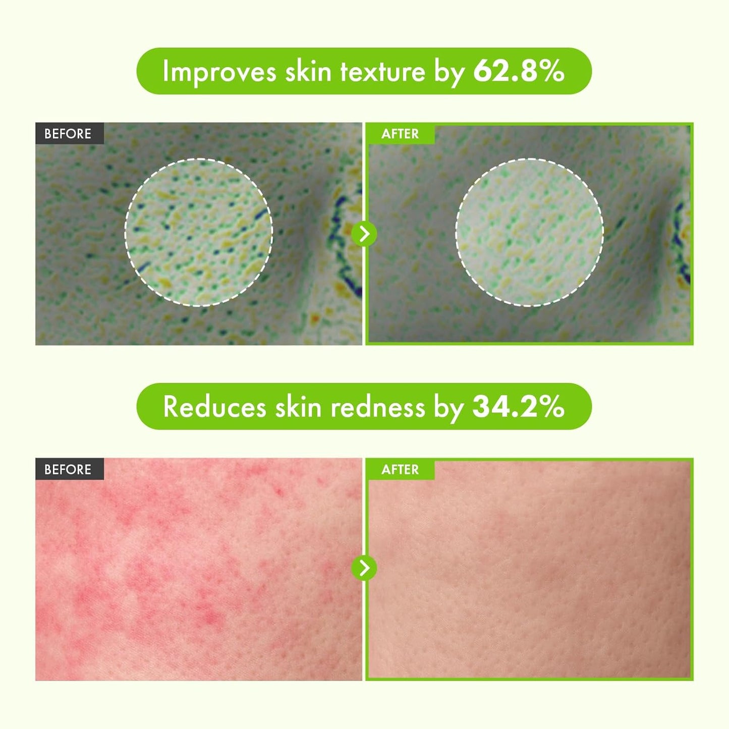 TOSOWOONG Green Tea Serum - 60% Panthenol for Calming & Hydration | 33 ml Korean Skincare
