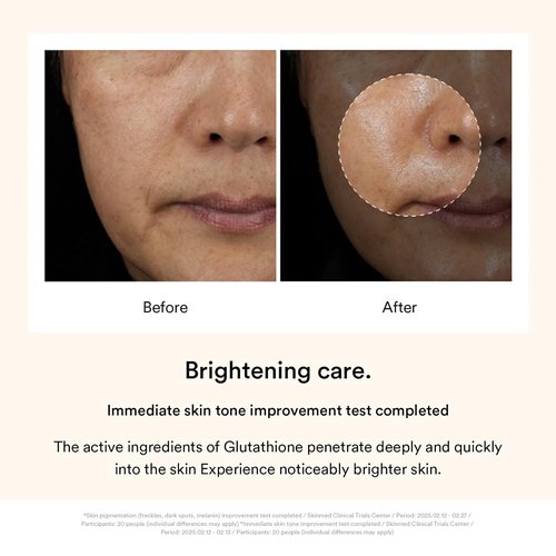 Abib Dark Spot Wrapping Mask - Brightening Peel Off Mask with Niacinamide & Vitamin C | 3.38 fl oz