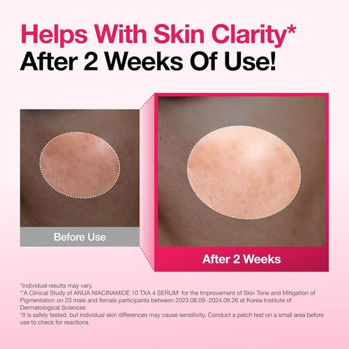 Anua Niacinamide 10 + TXA 4 Serum - Dark Spot Care & Hydration | Lightweight Korean Skincare 1.01 fl. oz