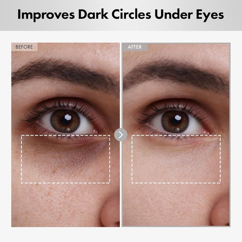 NATUREKIND Hyaluron Lifting Eye Cream - Hydrating Formula with Hyaluronic Acid & Niacinamide | 15ml