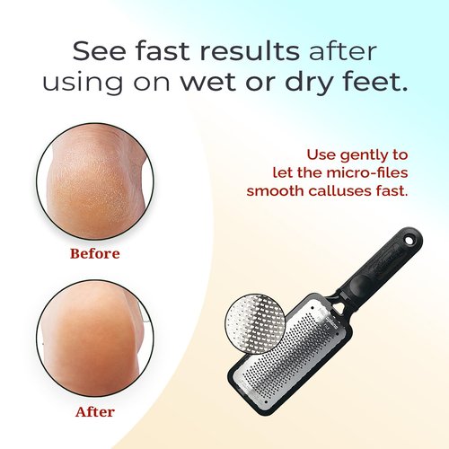 Microplane Colossal Foot File - Original Stainless Steel Callus Remover & Gentle Foot Scrubber | Black