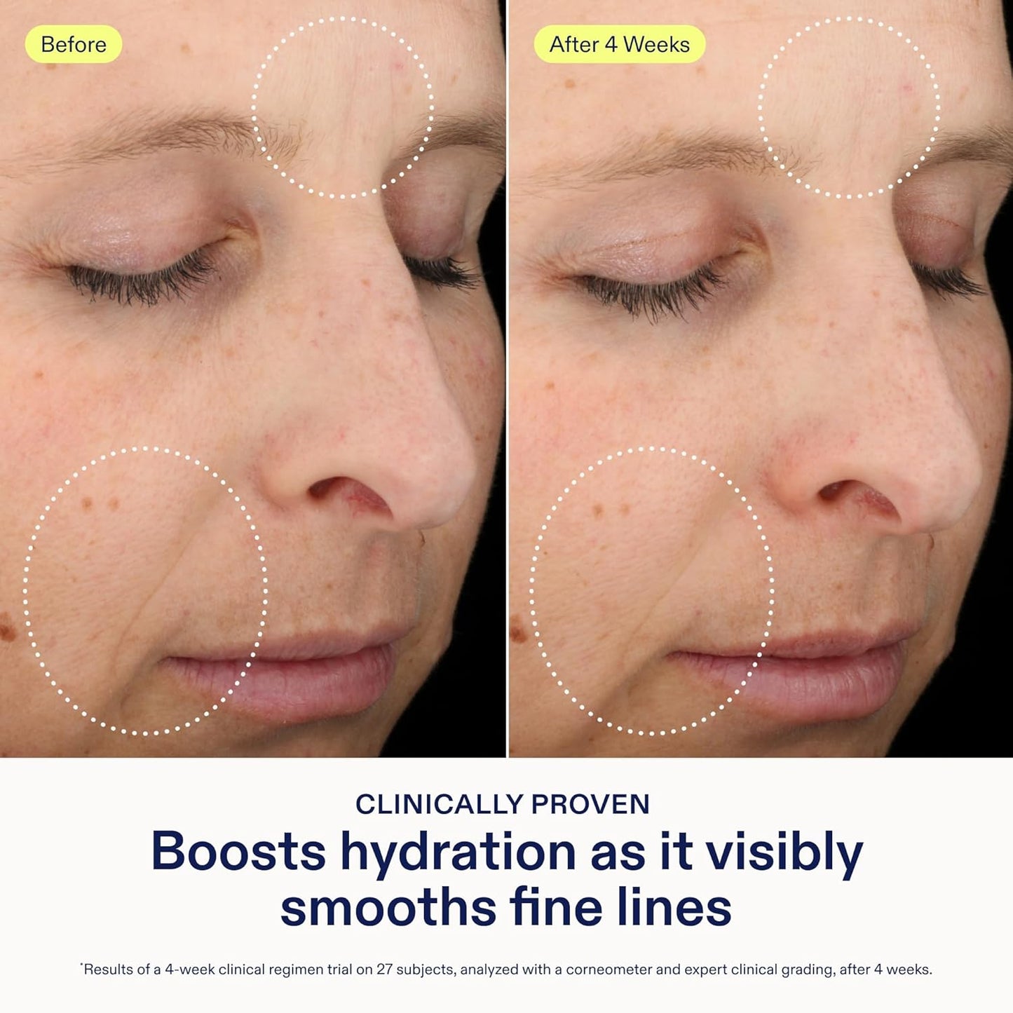 Skinfix Triple Lipid-Hyaluronate Serum - Hydrating Face Serum for Lasting Moisture - 1 oz | Smooths Fine Lines, Vegan & Cruelty-Free