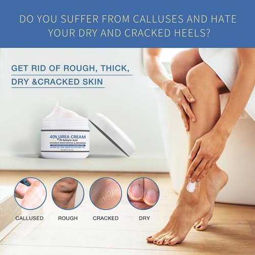 Rosarden Feet Cream for Dry Cracked Feet, 40% Urea Cream, Callus Remover Cream for Feet, Heels, Knees, Elbows, Hand, Moisturizing Foot Cream Softening Rough Skin On Feet, Rough Exfoliates Calloused