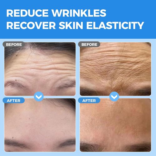 Okela Forehead Wrinkle Patches - Overnight Anti-Wrinkle Treatment with Collagen | 20 Pcs