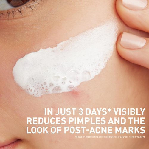CeraVe Acne Face Wash - Multi-Use Salicylic Acid & Kaolin Clay Treatment | 4oz, Fragrance-Free, Non-Comedogenic