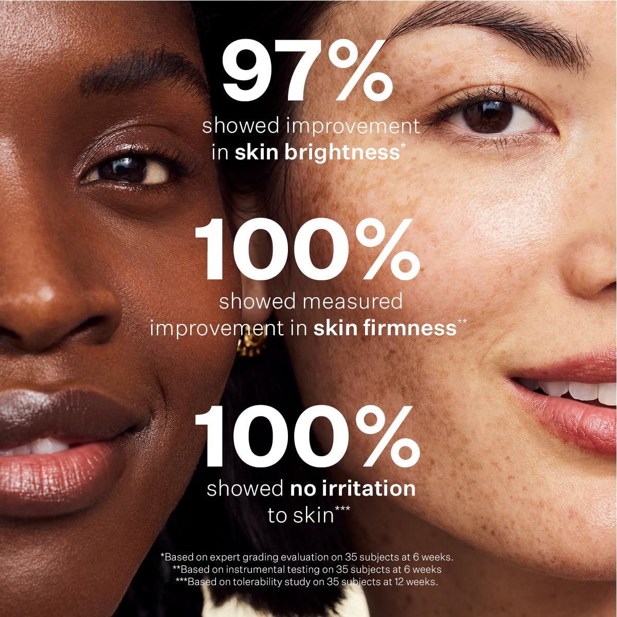 StriVectin Multi-Action Super C Retinol Serum - Brightening & Correcting Formula for Radiant Skin