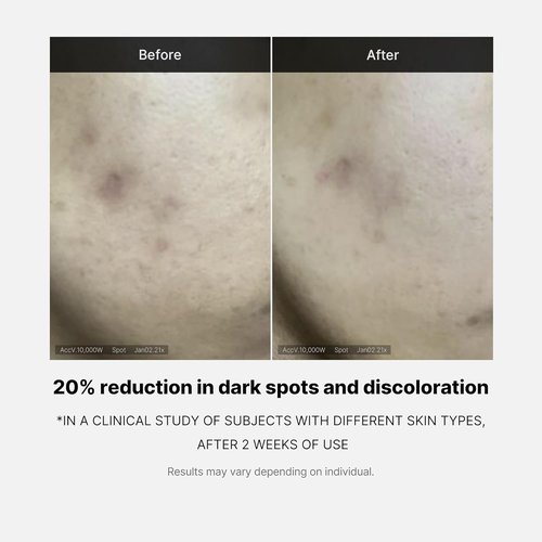 Medicube Deep Vita C Serum 2.0 - 14.5% Pure Vitamin C for Dark Spot Reduction | 3 Bottles (10g Each)
