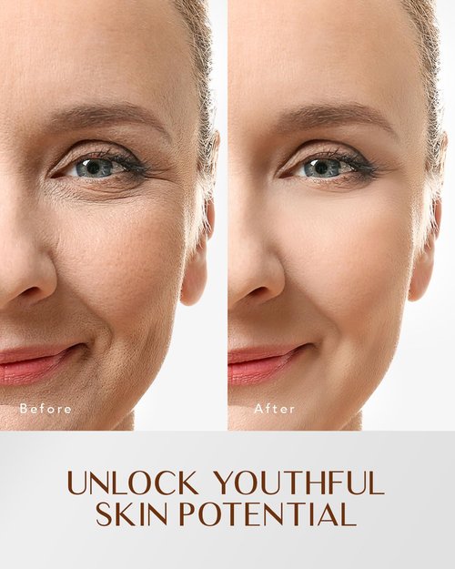EnaSkin Retinol Cream - Anti-Aging Facial Moisturizer for Wrinkles & Tightening Skin | 1.7 Fl Oz