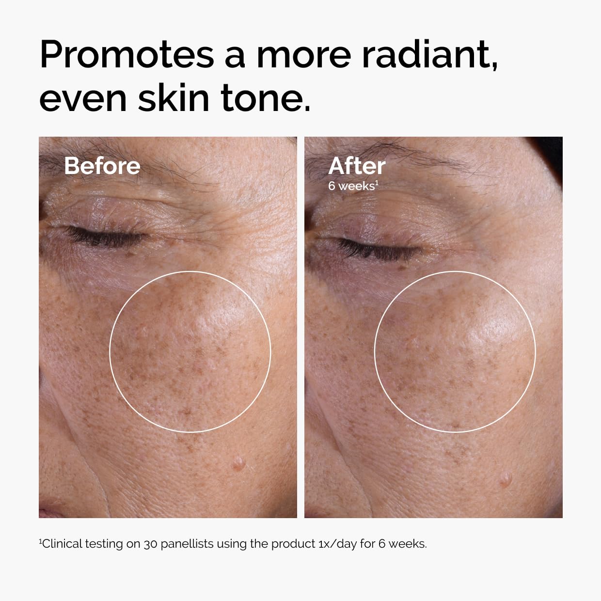 The Ordinary Glycolic Acid 7% Exfoliating Toner - Brightening & Smoothing Daily Skin Care