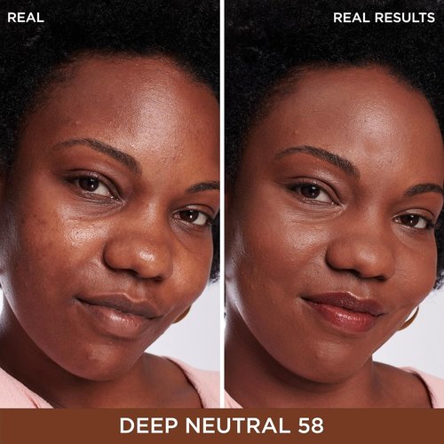 IT Cosmetics Bye Bye Dark Spots Concealer | Brightening Serum with 2% Niacinamide & Hyaluronic Acid - Medium Coverage, Natural Finish - 0.22 fl oz