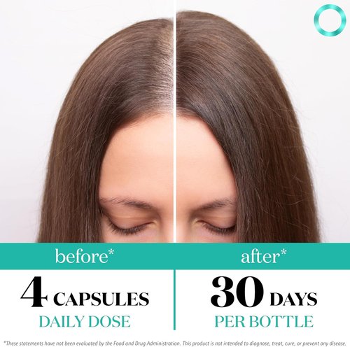 Regine Switzerland Women's Balance Hair Growth Supplements - Proven Formula for Thicker Hair | 2-Month Supply, Soy-Free, 26 Ingredients