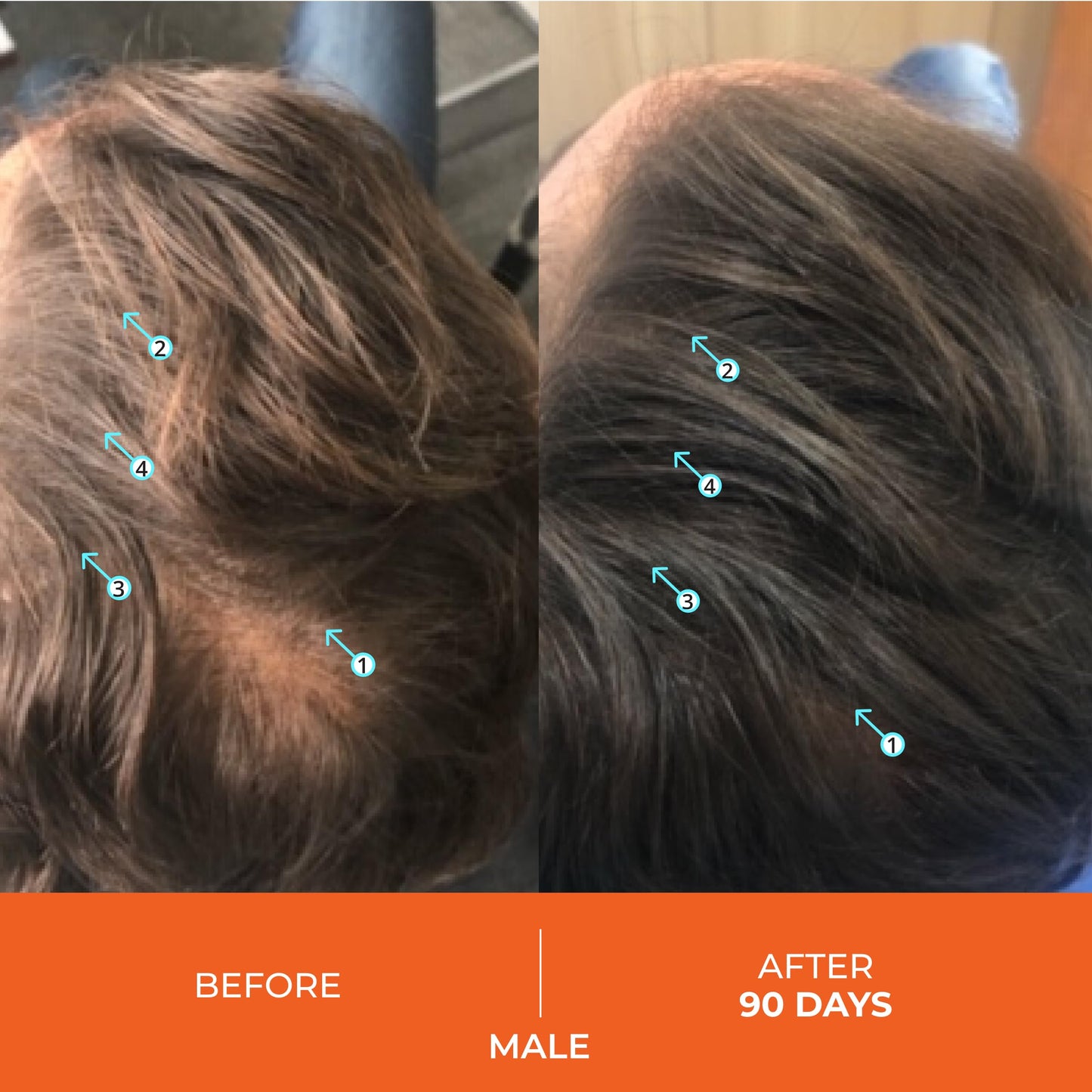 DS Laboratories Revita Shampoo and Conditioner Set - Hair Density Shampoo and Conditioner, Strengthening, Thickening, for Fine Hair, DHT Blocker for Women & Men, 205mL