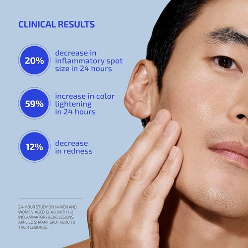 Codex Labs Shaant Spot Hero - 5% Sulfur Acne Treatment | Clinically Tested Formula for Sensitive Skin | 0.5 oz