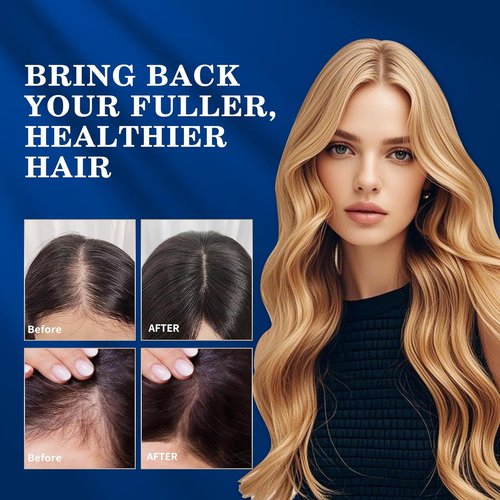 Regine Switzerland 5% Minoxidil Hair Growth Spray Kit - Extra Strength Treatment for Thinning Hair & Beard - 2PCS
