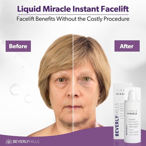 Beverly Hills Instant Facelift Eye Serum - Anti-Aging Treatment for Dark Circles & Puffiness | 30mL (120-Day Supply)