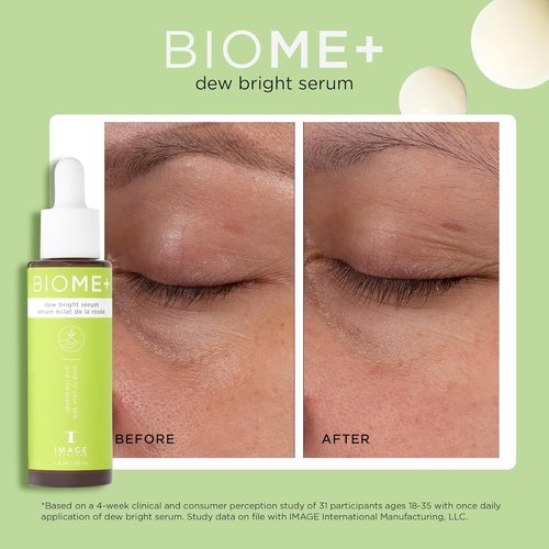 IMAGE Skincare BIOME+ Dew Bright Serum - Microbiome-Friendly Facial Serum for Enhanced Luminosity