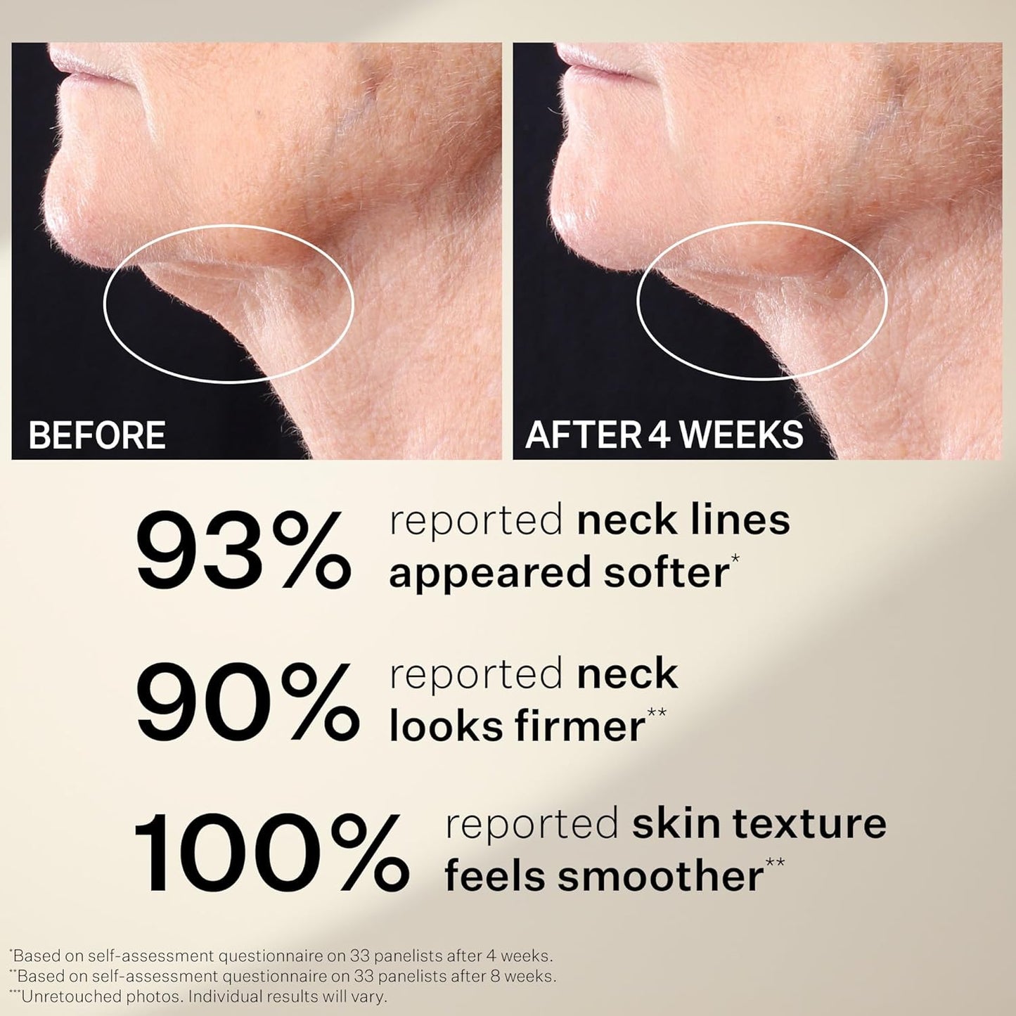 StriVectin Peptight™ Neck Tightening Anti-Aging Serum Roller - 1.7 fl. oz. for Youthful Skin