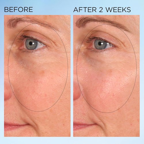 Elizabeth Arden Dark Spot Corrector - Vitamin C Serum Capsules for Radiant Skin & Even Tone