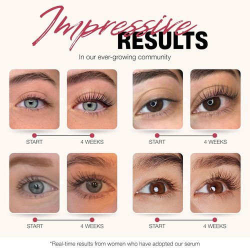 ROSEGOLD ROSELASH Growth Serum - Achieve Fuller, Longer, Thicker Lashes | 95% Natural, Vegan, Made in France