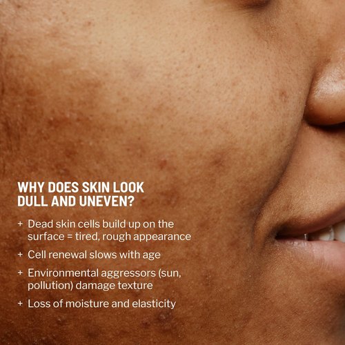 Dr. Brandt Advanced Microdermabrasion Face Exfoliator - Refines Texture, Minimizes the Look of Fine Lines & Enhances Overall Skin Tone