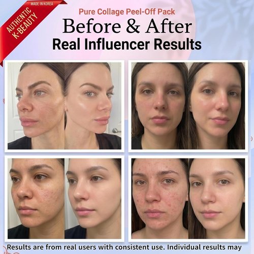 ELT Collagen Peel Off Face Mask - Hydrating & Firming Korean Facial Mask with 5 Collagens | 60 ml