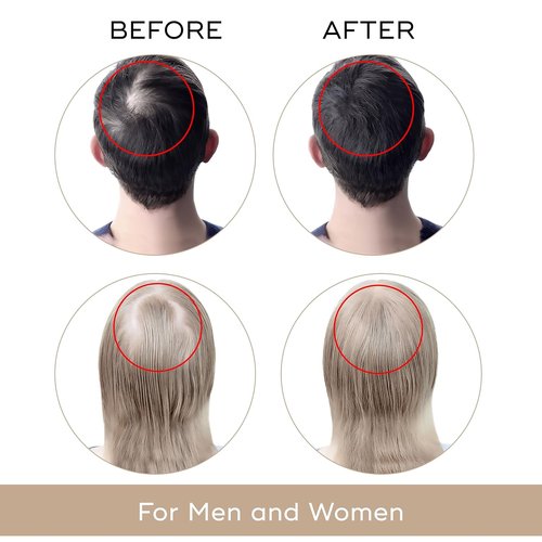 Dekohair Hair Regrowth Serum - Stops Thinning, Promotes Growth & Increases Root Volume | USA Made