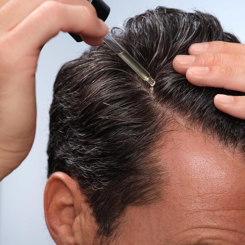 Caldera + Lab Hair Serum - Men’s Thickening Formula for Thinning Hair, Supports Fuller & Stronger-Looking Hair, Dermatologically Tested