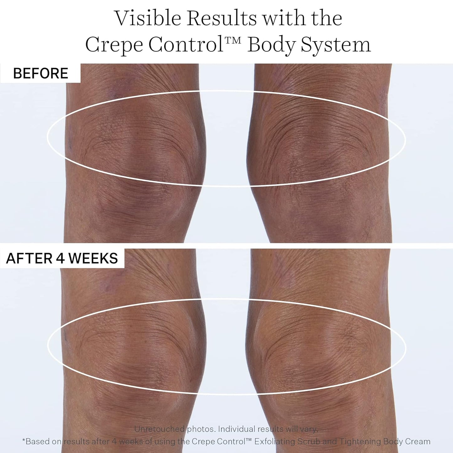 StriVectin Crepe Control Body Cream - Tightening Formula | Jumbo Size for Enhanced Firmness