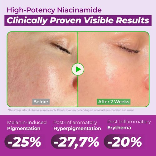 JUMISO Niacinamide 20 Serum - Korean Face Serum with Glutathione, TXA Tranexamic Acid and Centella Complex - Reduces Pigmentation, Uneven Skin Tone, Pore Care for Sensitive Skin, 1.35 fl.oz.