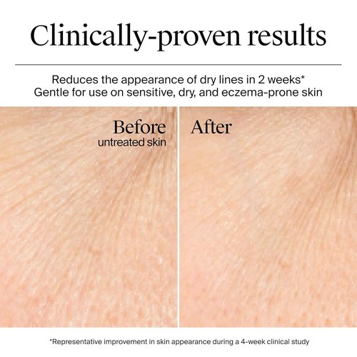 Neutrogena Hydro Boost Gel Cream - 48 Hr Hydration Face Moisturizer with Hyaluronic Acid | 1.7 oz + Trial Size Cleanser 0.5 fl oz