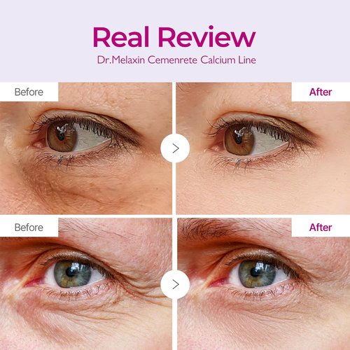 Dr. Melaxin Calcium Volume Eye Patch - Firming Treatment for Wrinkles, Puffiness & Dark Circles | 60 Patches