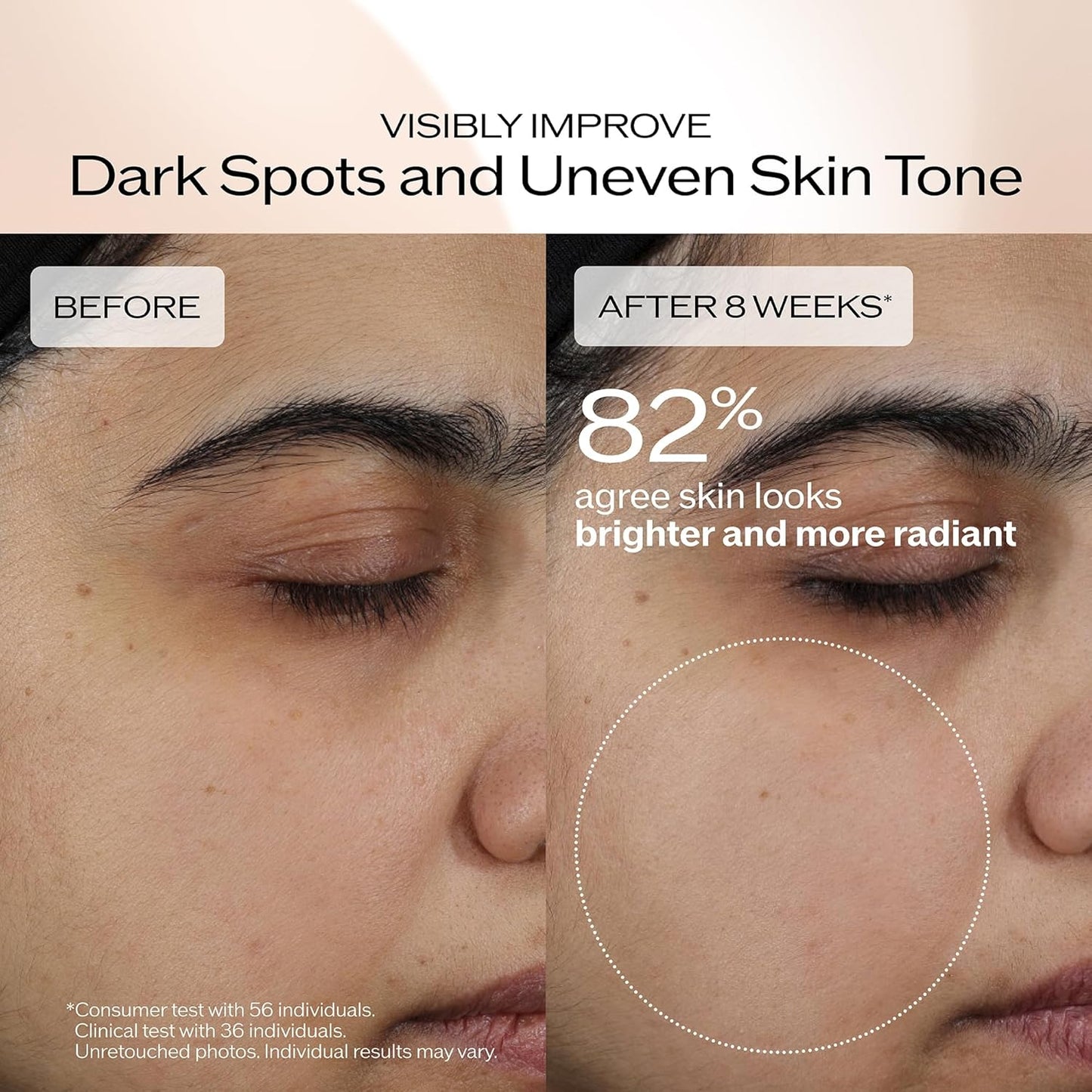 Shiseido Benefiance Brightening & Wrinkle Smoothing Cream - Plant-Based Retinol Moisturizer for Dark Spots & Wrinkles - 24HR Hydration, Non-Comedogenic