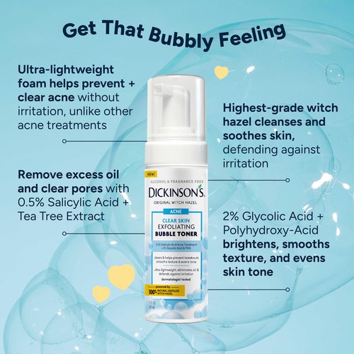 Dickinson’s Witch Hazel Exfoliating Bubble Toner with 0.5% Salicylic Acid, Glycolic Acid & Niacinamide | Clears Pores, Smooths Texture, Brightens Skin | Alcohol-Free, Fragrance-Free | 5 Fl Oz