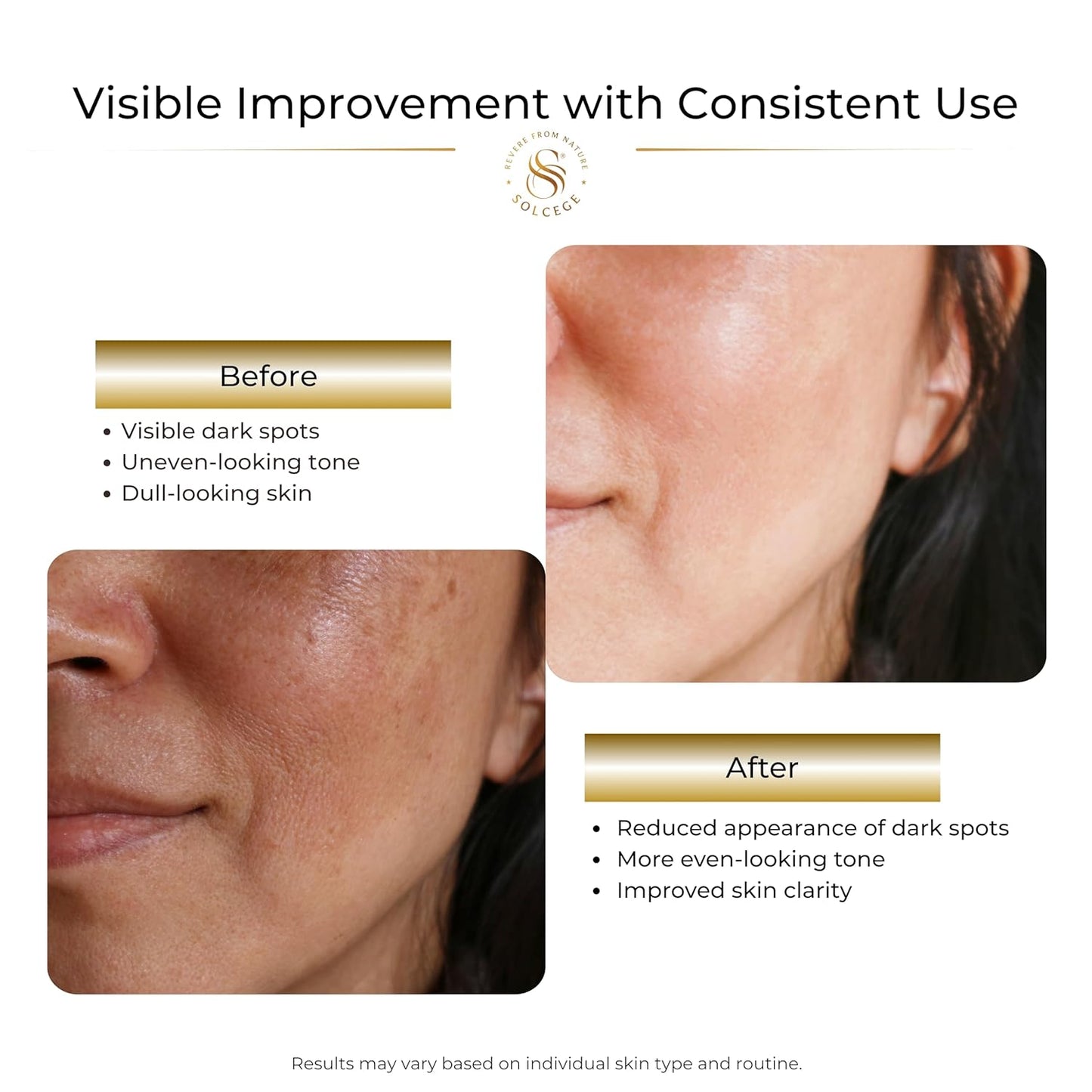 Skiennix Vitamin C Serum - Brightening Dark Spot Corrector with Niacinamide & Retinol, 1 oz.