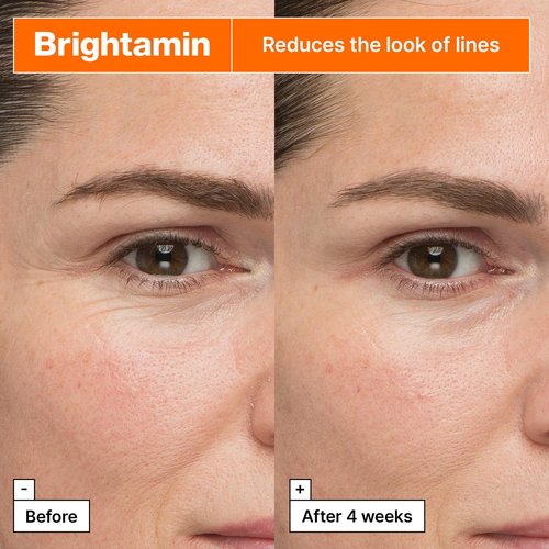 Dr.Jart+ Brightamin Brightening Serum - Vitamin C & Niacinamide for Fine Lines | Dark Spot Corrector, 0.27 Fl Oz