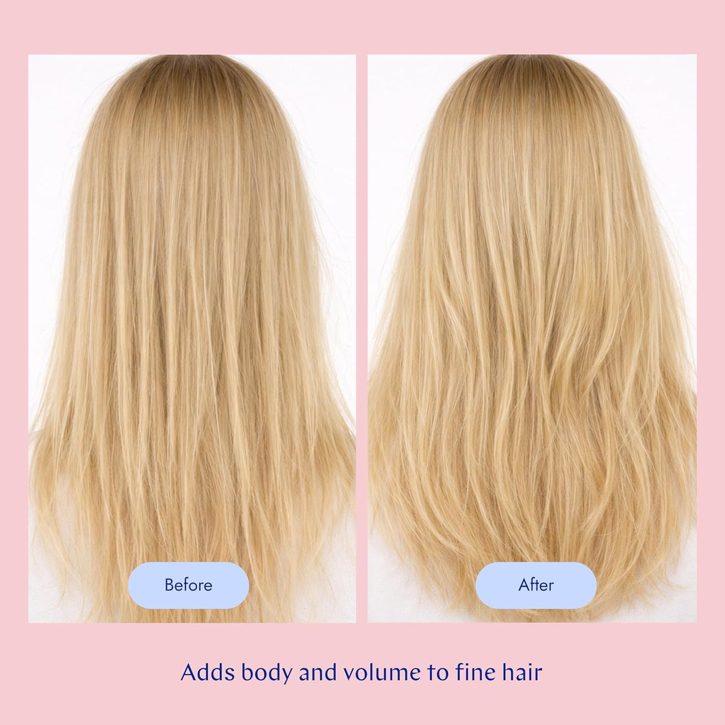 Skiennix Volume Shampoo - 10.1 Fl Oz | Builds Volume, Prevents Breakage & Color Preserving, Vegan
