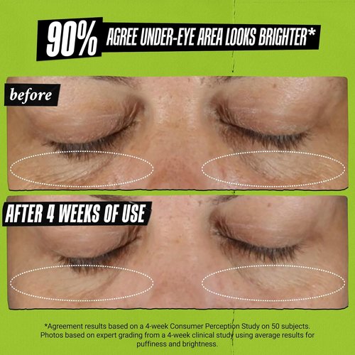 Kiehl's Avocado Eye Treatment - Nourishing Under Eye Cream for Puffiness & Dark Circles | Caffeine Infused
