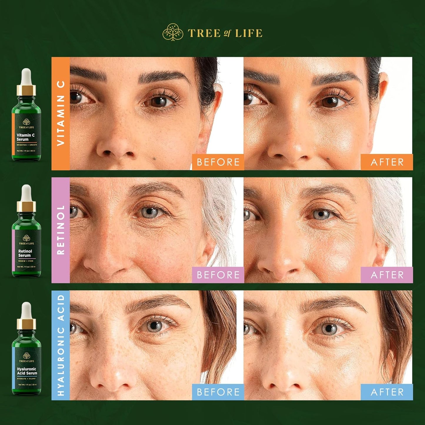 Tree of Life Beauty Facial Skin Care Set - Brightening & Hydrating Serums with Vitamin C, Retinol & Hyaluronic Acid | 1 Fl Oz (Pack of 3)