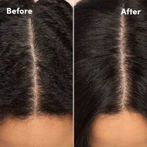 Mizani Scalp Care Calming Scalp Lotion - Soothing Dandruff Treatment with Eucalyptus & Avocado Oil