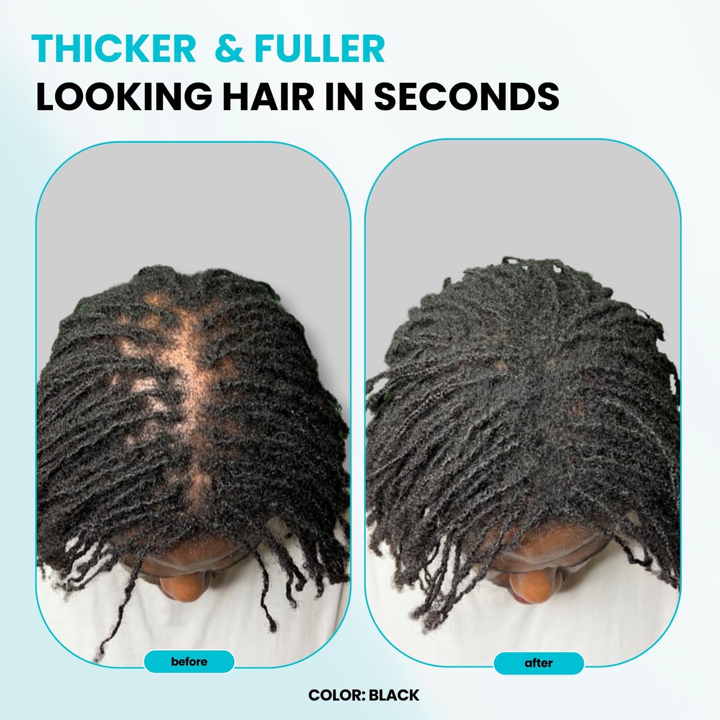 SURETHIK Hair Fibers, 30g (Auburn), Fills Thinning Hair for Visibly Fuller Look, Conceals Bald Spots, Natural Look, For Men & Women