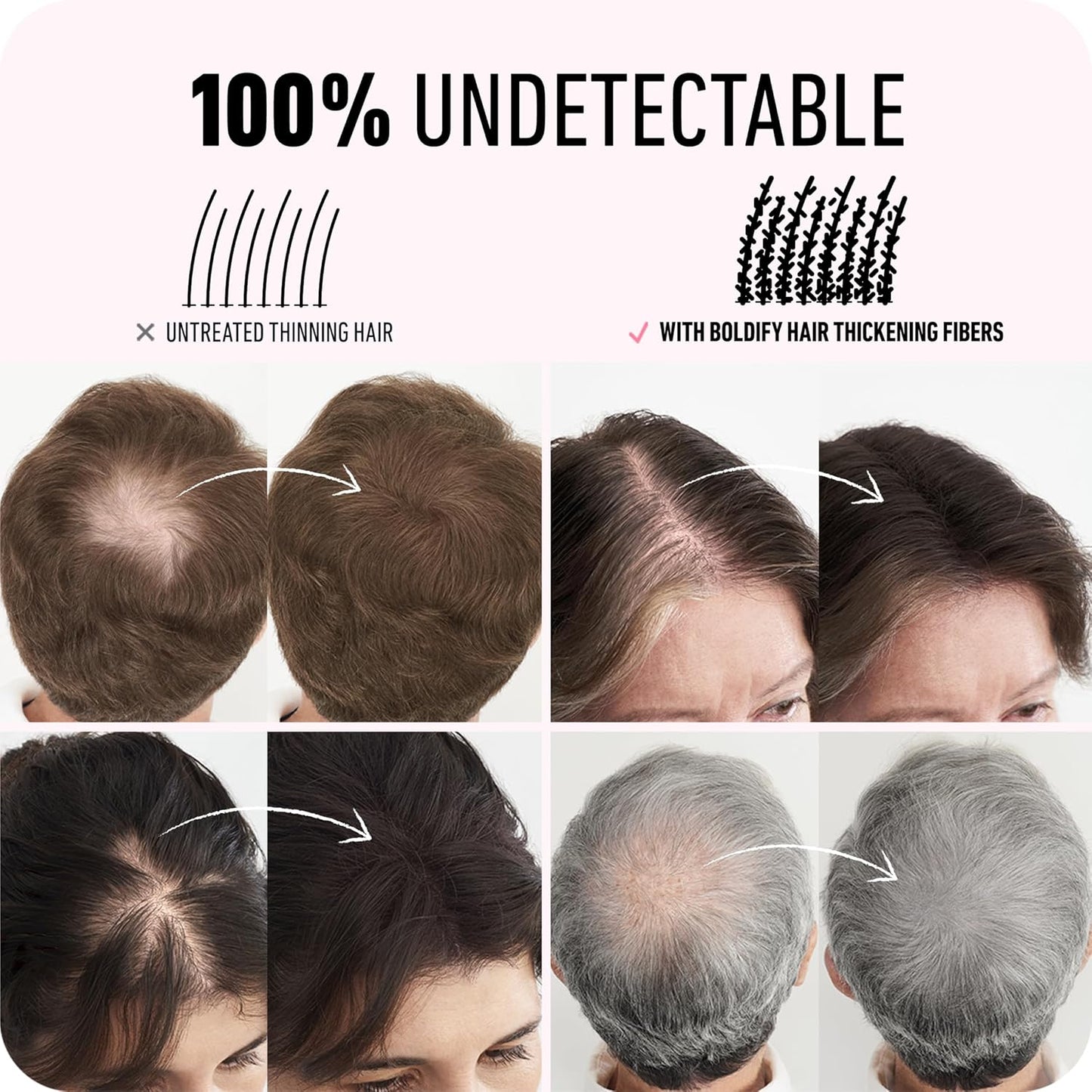 BOLDIFY Hair Fibers - Instantly Thicker & Fuller Hair for Thinning Hair - 12.5g | Light Brown - 14 Shades Available
