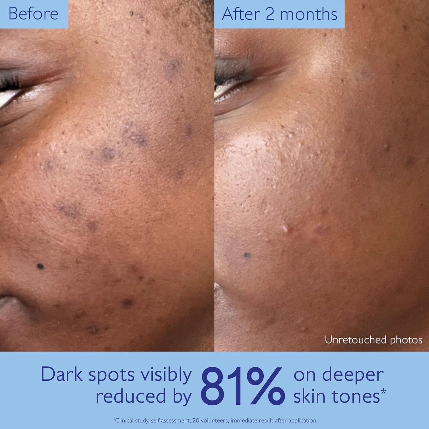Caudalie Vinoperfect Brightening Dark Spot Serum | 62x More Effective Than Vitamin C for Even Skin Tone