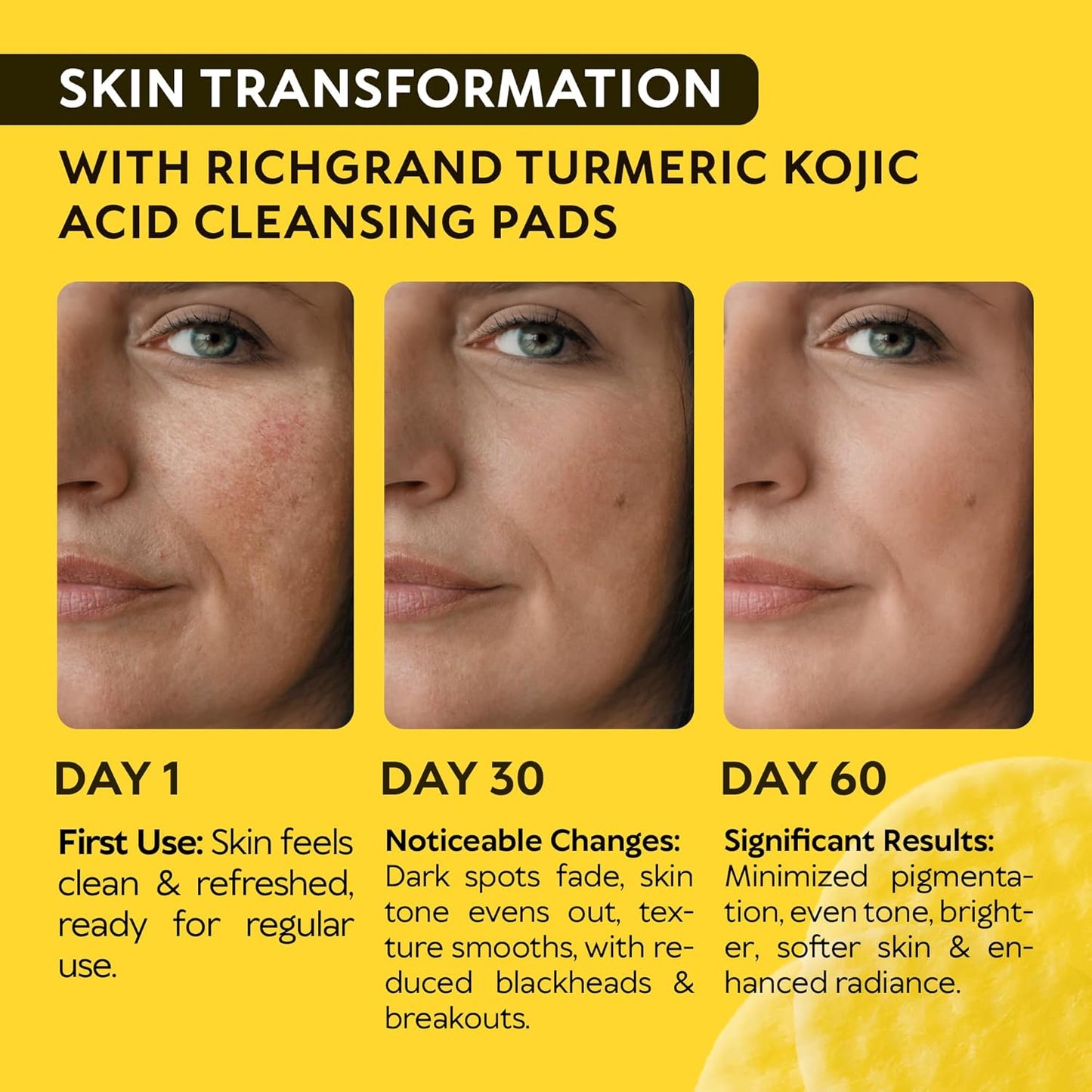 Turmeric Kojic Acid Cleansing Pads - Exfoliating Face Sponges with Vitamin C & Lemon for Glowing Skin