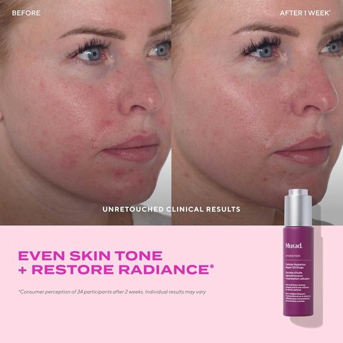 Murad Cellular Hydration Repair Oil Drops - Hydrating Facial Oil for Dry Skin - Boosts Radiance & Smoothness - 1.0 oz