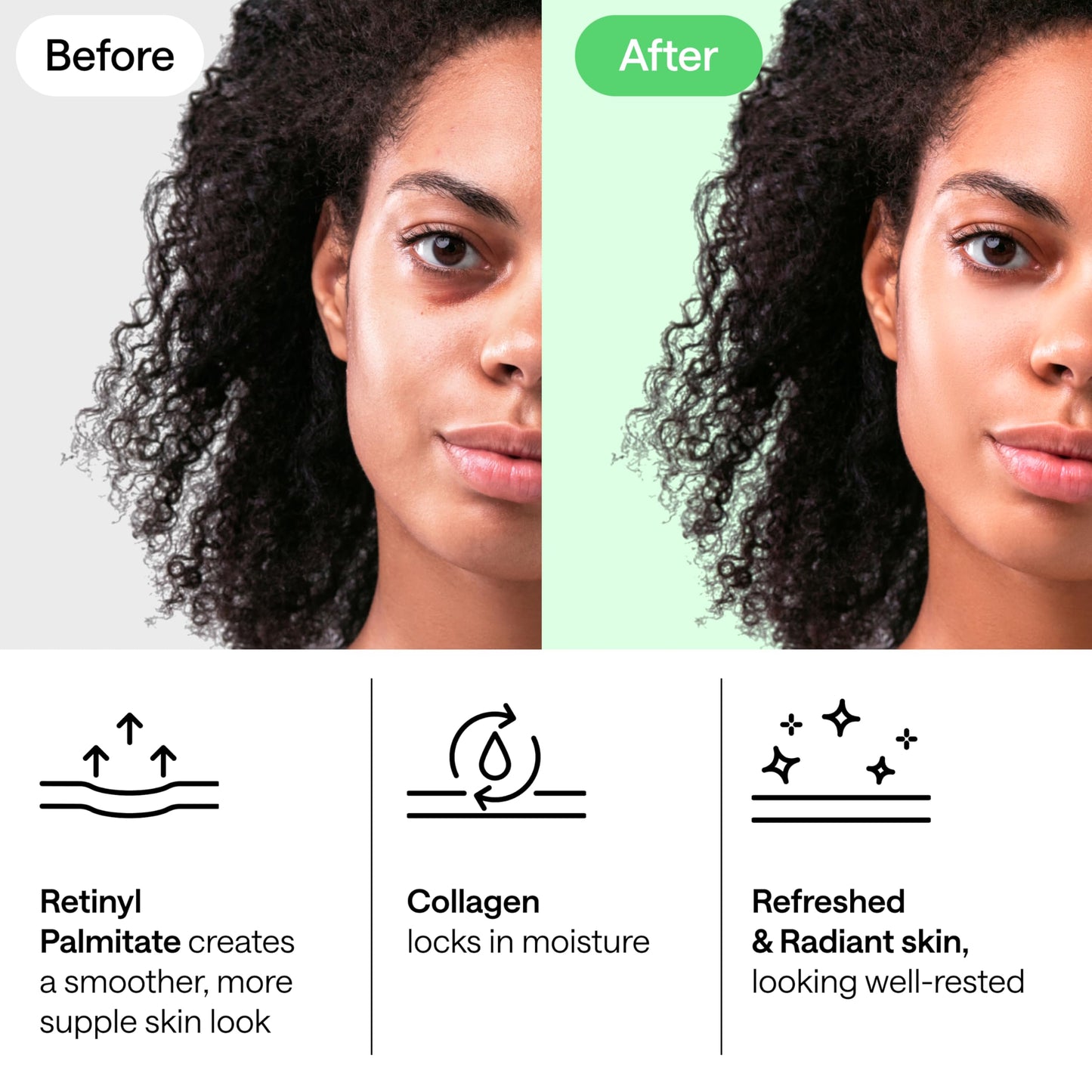 Under Eye Patches for Dark Circles, Puffiness 5 PAIRS - Dark Circles Under Eye Treatment - Under Eye Mask Gel - Under Eye Gel Patches for Puffy Eyes - Green Tea, Collagen Eye Patches - Under Eye Pads