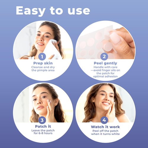 PatchRx Pimple Patches for Face (240 Patches), Hydrocolloid Acne Patches with Tea Tree Oil & Salicylic Acid, Pimple Patch Pimple Stickers, Hydrocolloid Patch Acne Dots Acne Pimple Patches For Face