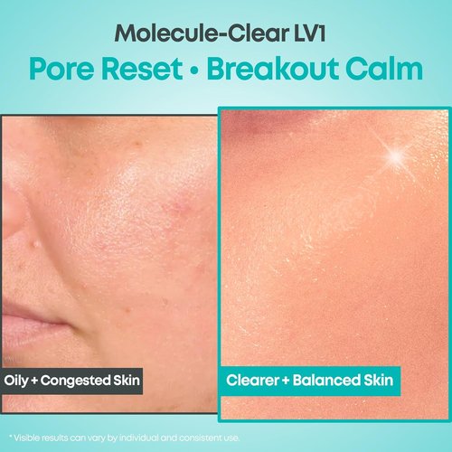 NINELESS Salicylic Acid Serum - Deep Pore Exfoliating for Oily Acne-Prone Skin | Hydrating & Soothing, 1.01 fl oz