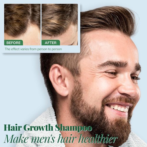 Regine Switzerland Hair Growth Shampoo - Rosemary & Biotin Formula for Thickening, 12.8 Fl Oz