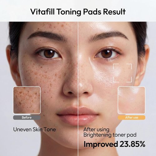 Licorne Vitafill Toning Pads - Hydrating Korean Toner Pads with Niacinamide for Smooth, Radiant Skin