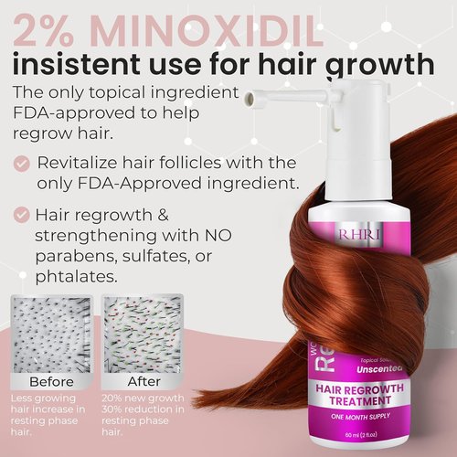Minoxidil 2% Hair Regrowth Spray for Women | Thicker, Fuller Hair - Clinically Proven Formula - 60 ml